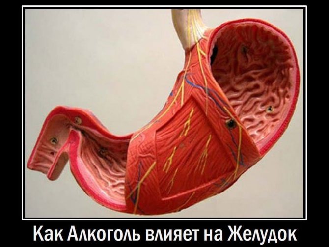 Alcoholic gastritis. How alcohol affects the stomach. 