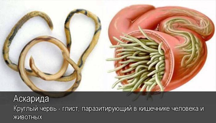 Roundworms are parasites in the human body