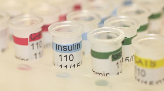Что такое инсулин (гормон поджелудочной железы): структура, разновидности