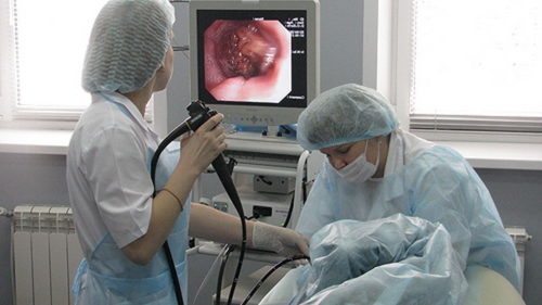 How is esophageal manometry done?