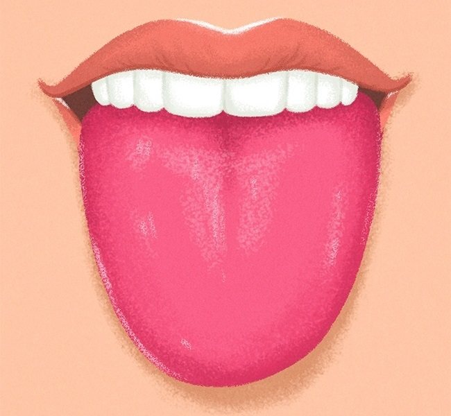 What color is the tongue for diseases? Causes of white, yellow, green, dark, brown plaque 