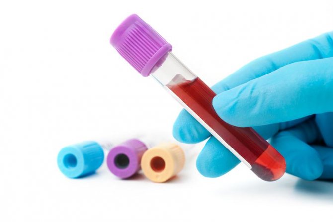 Clinical blood test