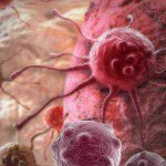 where does colon cancer metastasize?
