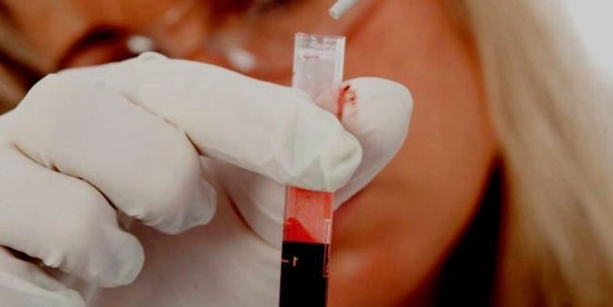 Laboratory technician performing a blood test