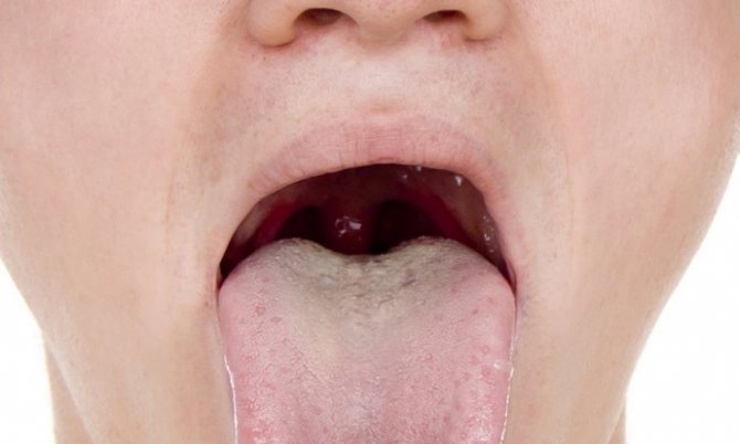 A coating on the tongue often indicates liver problems.