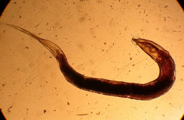 Pinworm under a microscope