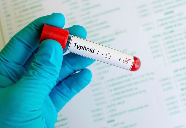 typhoid prevention