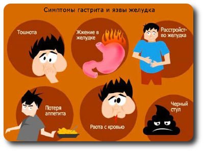 Symptoms of gastritis and ulcers