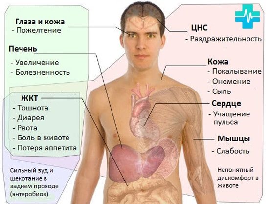 Symptoms of infection with parasites - picture on gemoparazit.ru