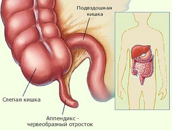 symptoms of Rovzinga Sitkovsky