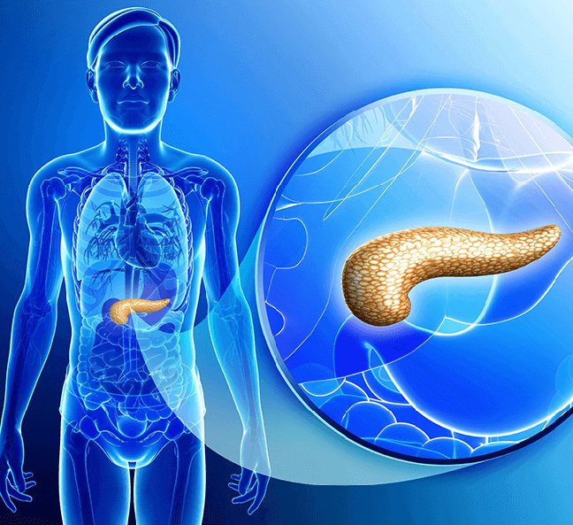 Pancreatic steatosis: what is it and how is it treated. Diet for pancreatic steatosis. 