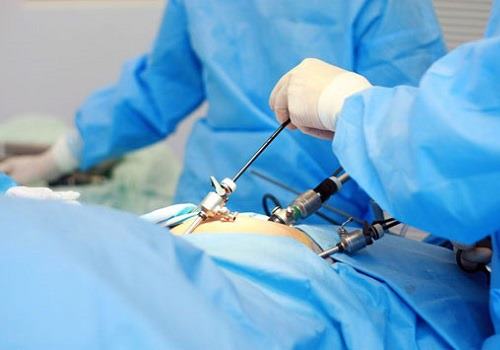 Doctors perform laparoscopy of the pancreas